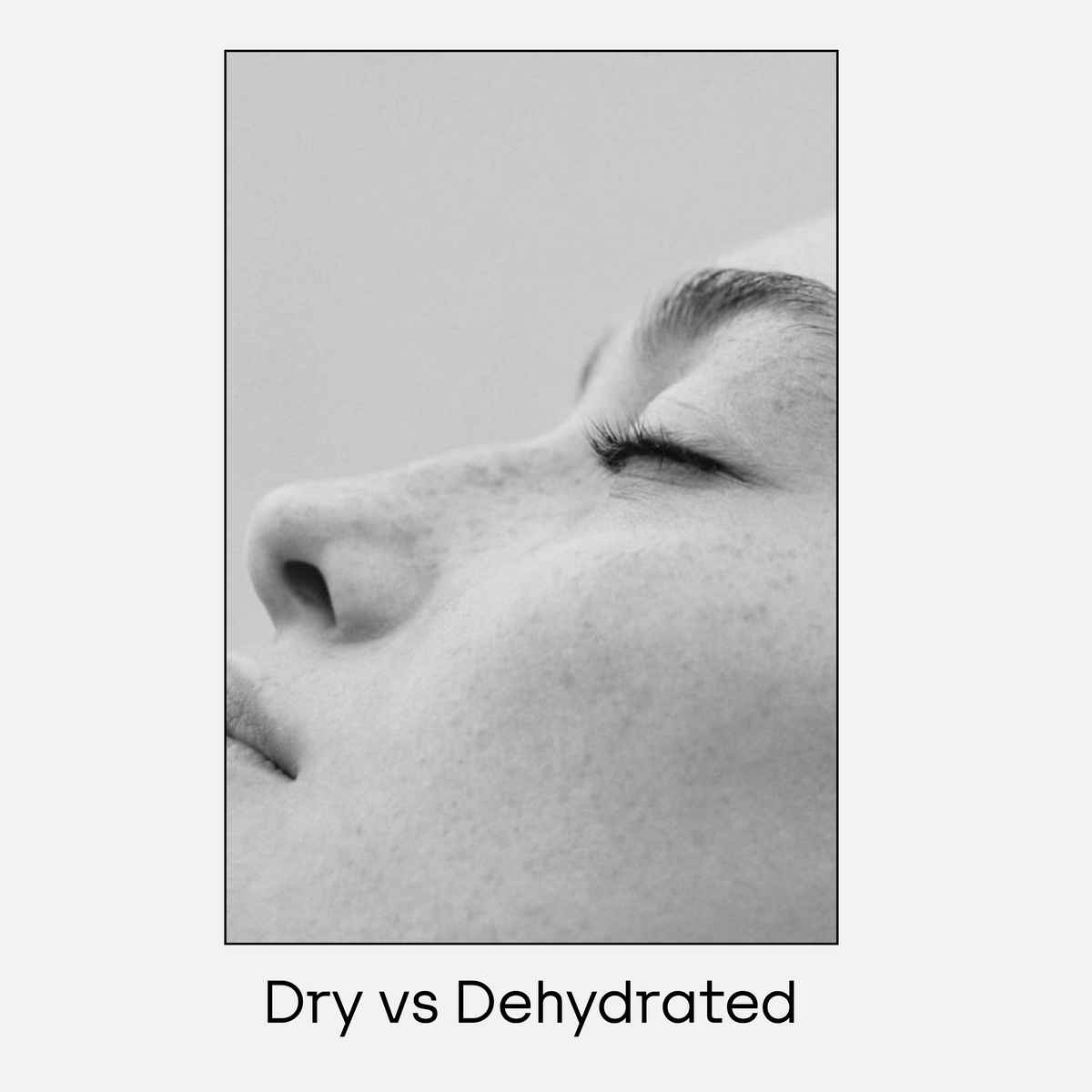 Dry or Dehydrated?